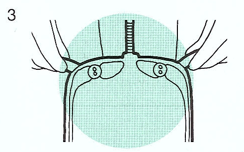 https://www.mystoma.ru/published/publicdata/WWWMYSTOMAORGWEBASYST/attachments/SC/images/1_1 (4).jpg